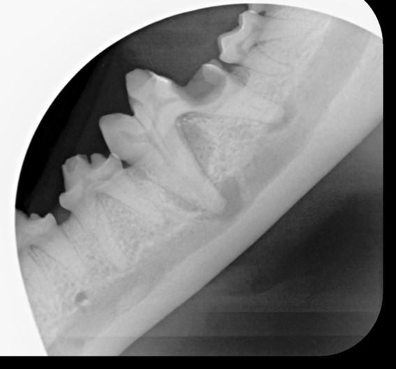 ​Dental radiography