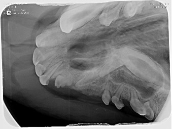 Complicated and surgical extraction X-ray