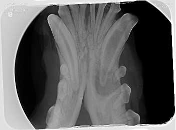 ​Dental radiography