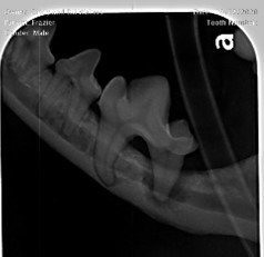 Complicated and surgical extraction X-ray