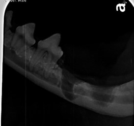 Complicated and surgical extraction X-ray