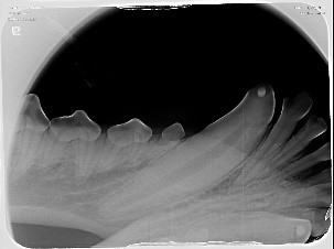 Endodontics